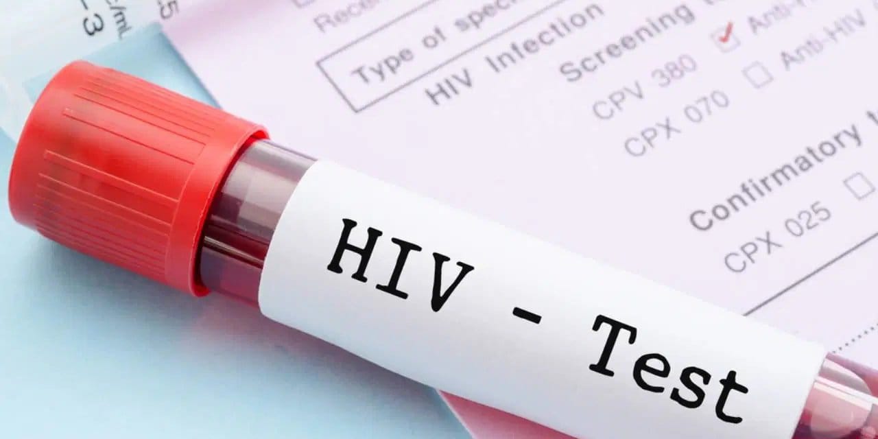 turkiyede-hiv-alarmi-sessiz-pandemi-mWijjInE.jpg